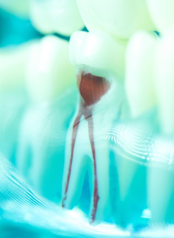 man smiling in dentists chair